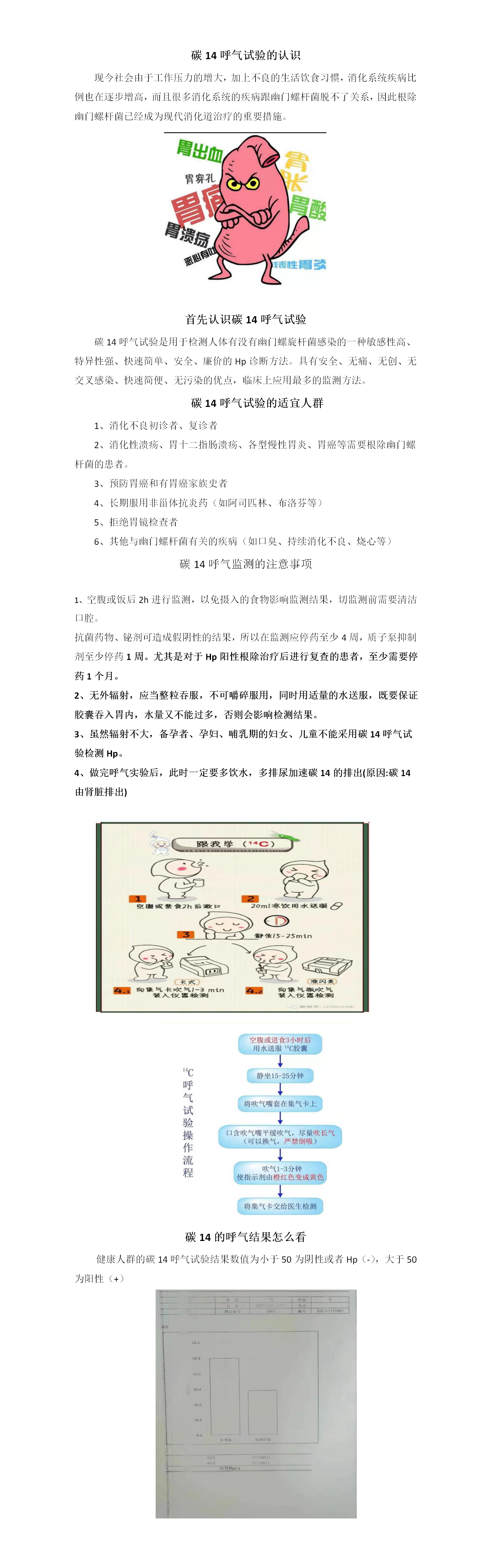 消化内科一病区-碳14呼气试验的认识.png