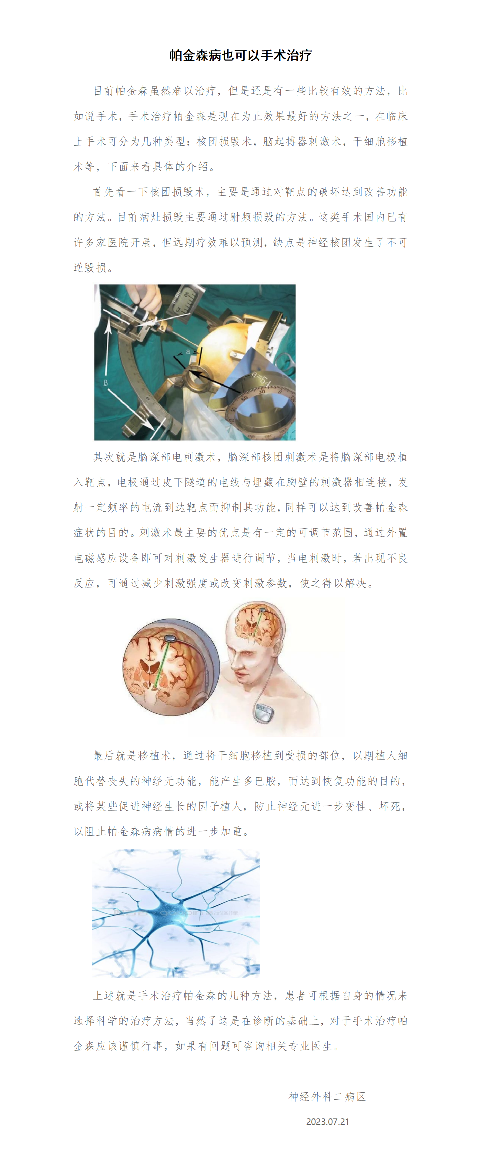 神经外二科普-手术治疗帕金森病_01.png
