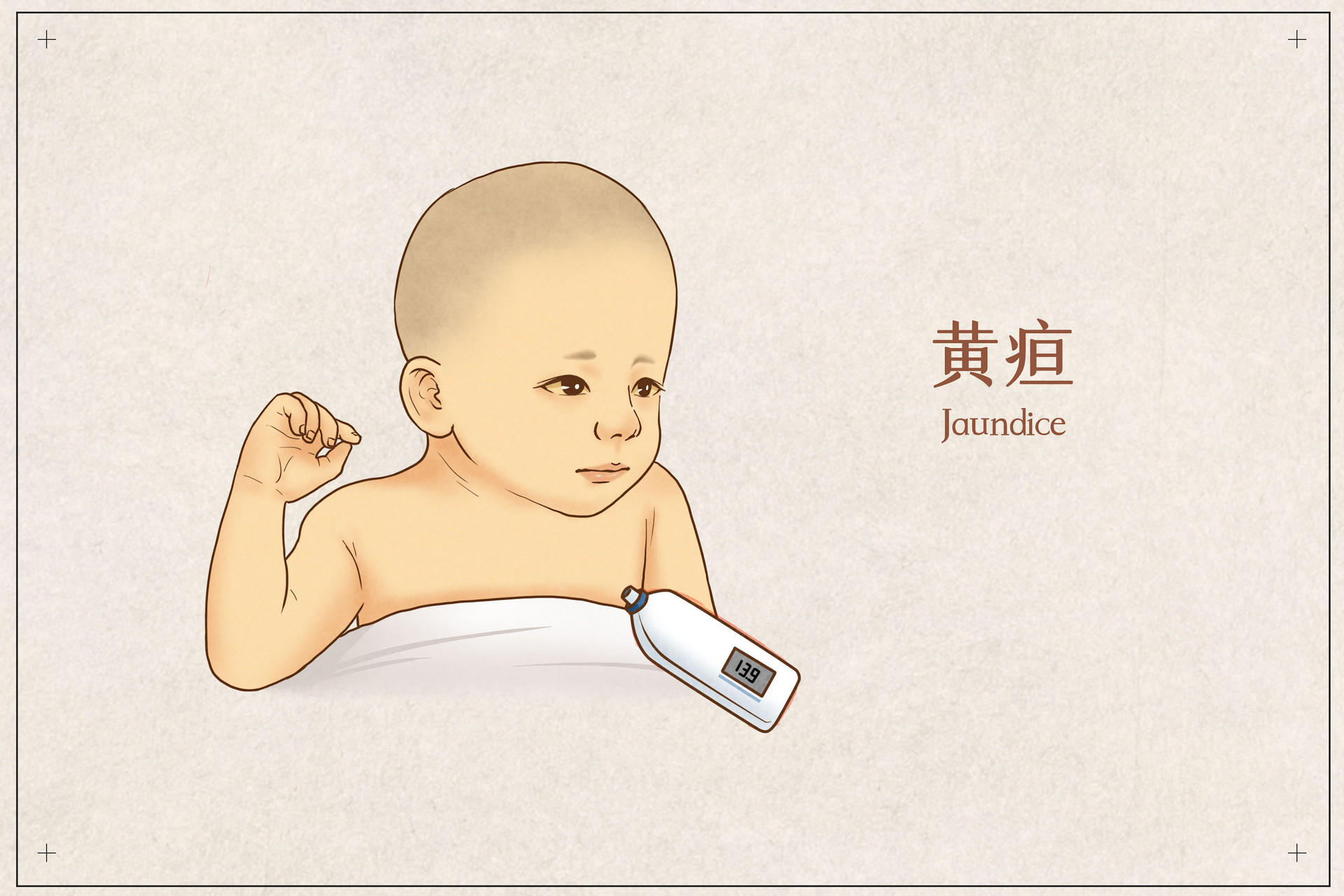 摄图网_401789561_banner_儿童黄疸医疗插画(企业商用).jpg 摄图网_401789561_banner_儿童黄疸医疗插画(企业商用).jpg
